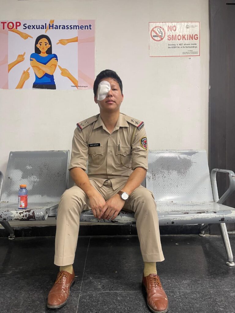 SI Tamo Bakhang injured in stone pelting during bandh